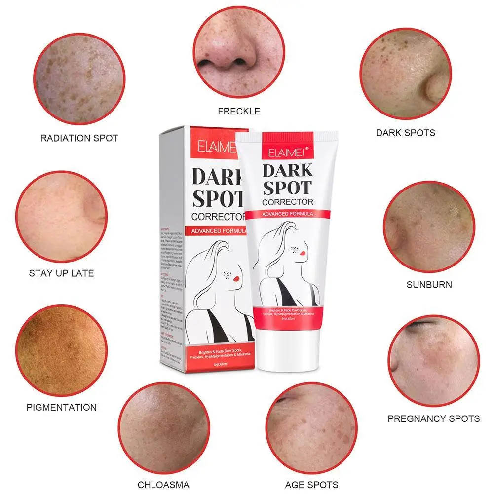 

Effective Freckle Cream Whitening Remove Dark Spots Cream Repair Fade Freckls Melanin Remover Brighten Skin Care