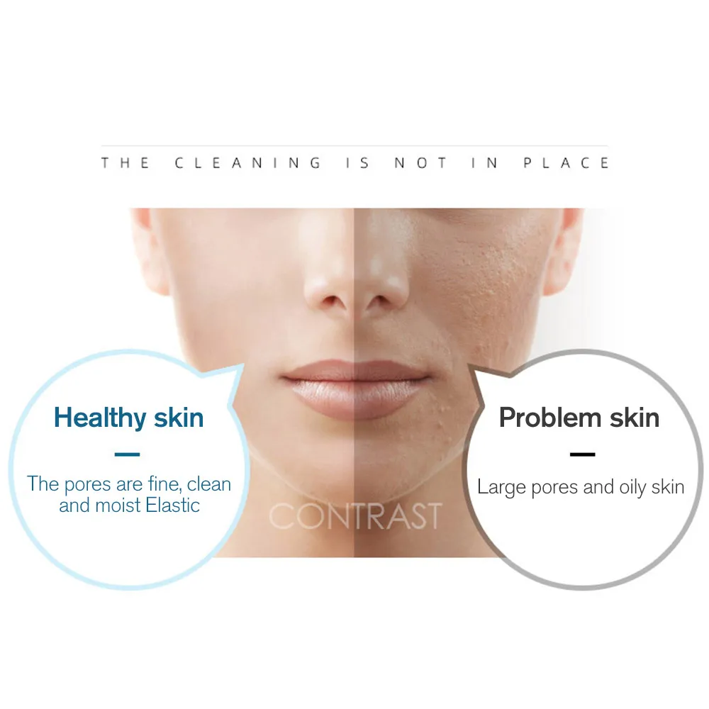 

Пилинг-аппарат для лица, 6 цветов, спа, Глубокая очистка, косметическое устройство для домашнего использования, вакуумный пилинг черных точек, маленький пузырьковый пилинг