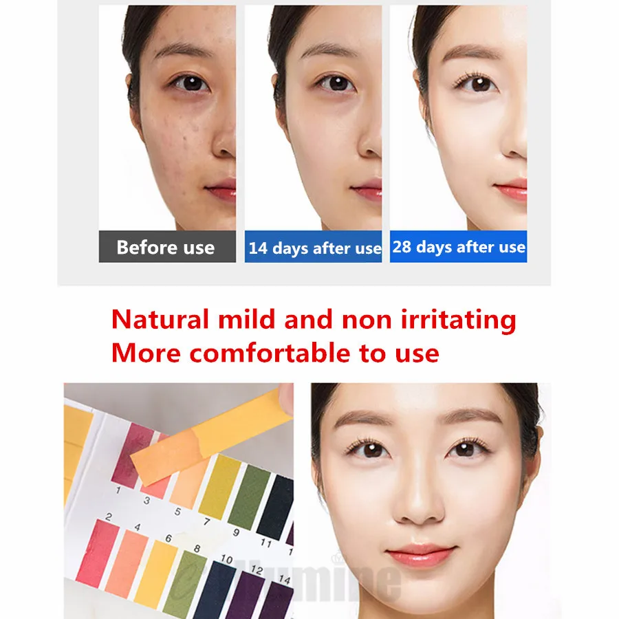 Эссенция с лепестками роз 1000 мл эссенция для лица пополнение воды Осветление