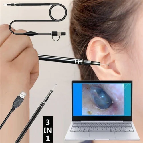 3 в 1 ушной эндоскоп USB 5 мм визуальный наушник HD камера ложка Otoscope для смартфона
