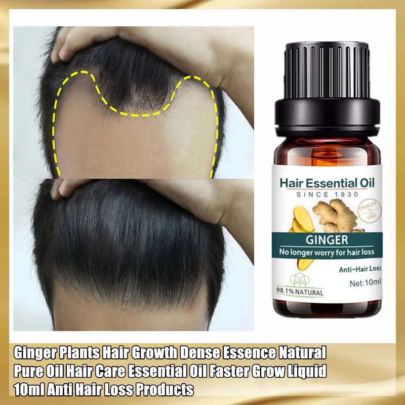 

Hot sale Fast Hair Growth Essence Oil Hair Loss Treatment Help for hair Growth Hair Care 10ml ginger oil Hair and scalp repair