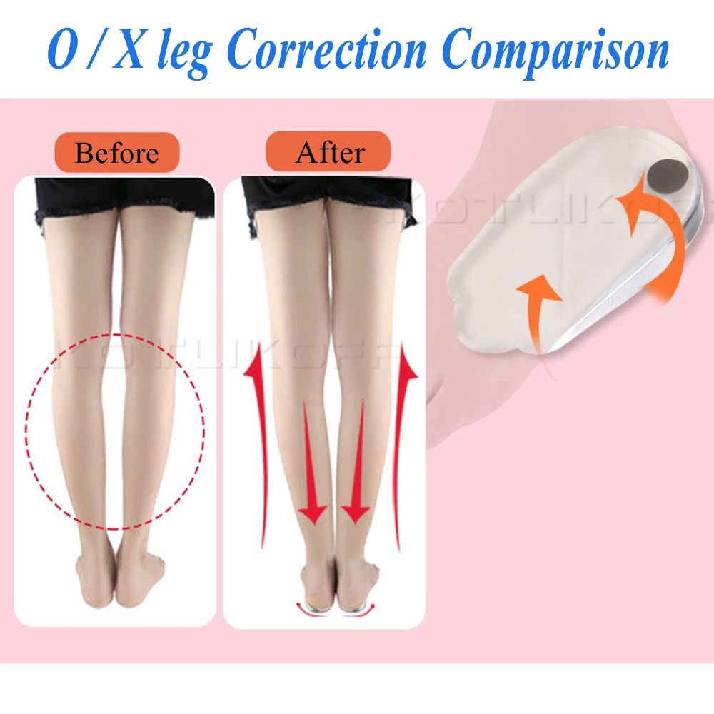 Magnetic Massage Insoles Gel O/X Type Leg Orthotics Heel Pads Corrective Valgus Varus Foot Magnet Massage Insoles Insert Pads