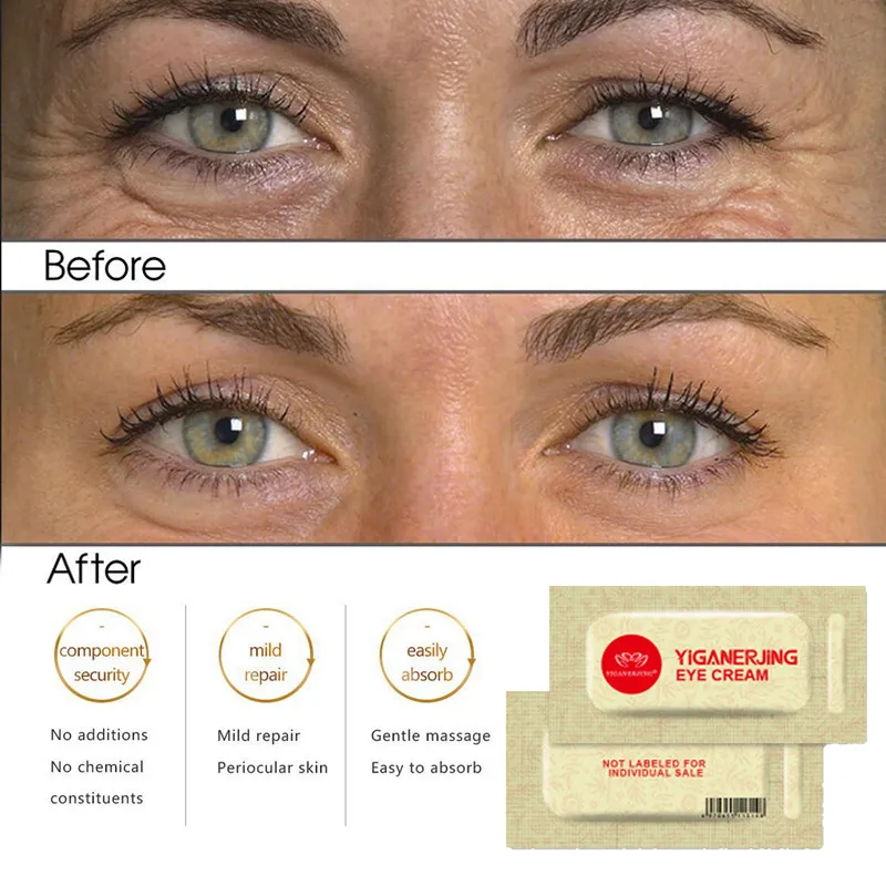 100 шт. антивозрастной крем для кожи вокруг глаз с футляром |