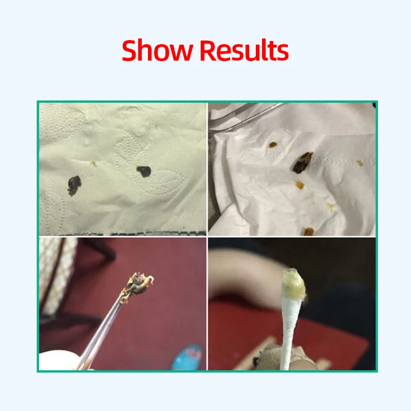 Капли для ушей 10 мл бикарбонат натрия фрикарбонат жидкость лечения острого и