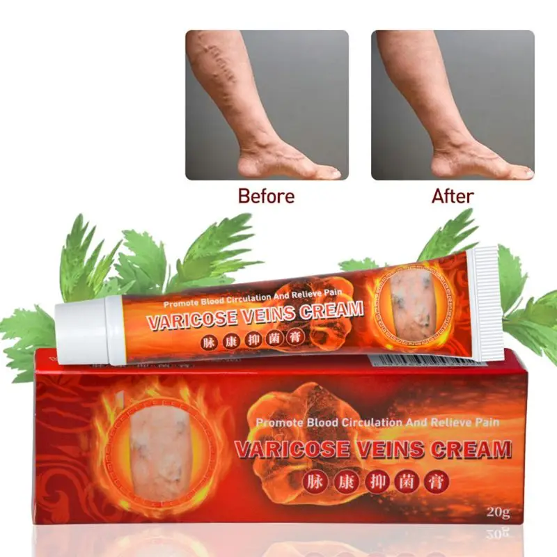20g Varicose Veins Treatment Cream Herbal Vasculitis Phlebitis Pain Relief Angiitis Inflammation Rotten Legs Ointment Foot Care | Красота и