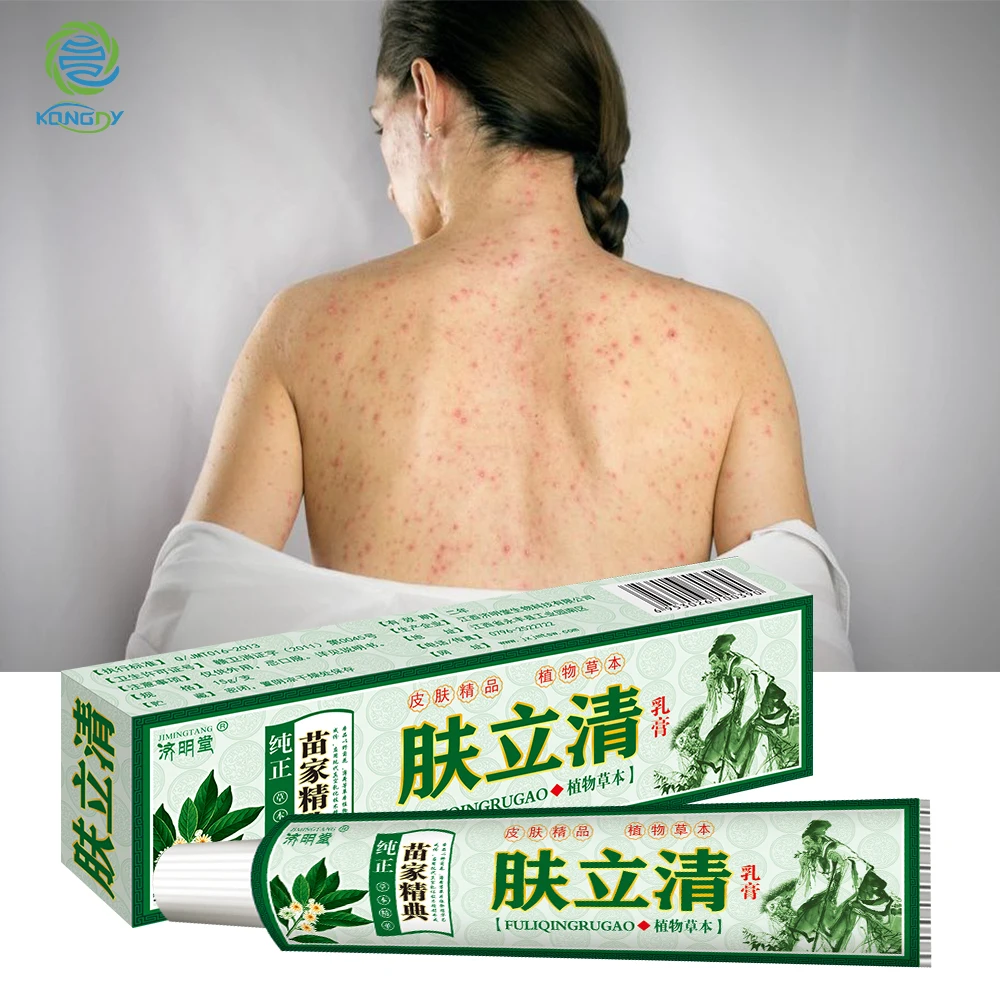 KONGDY крем от псориаза китайский традиционный пластырь 1 шт. облегчает дерматит
