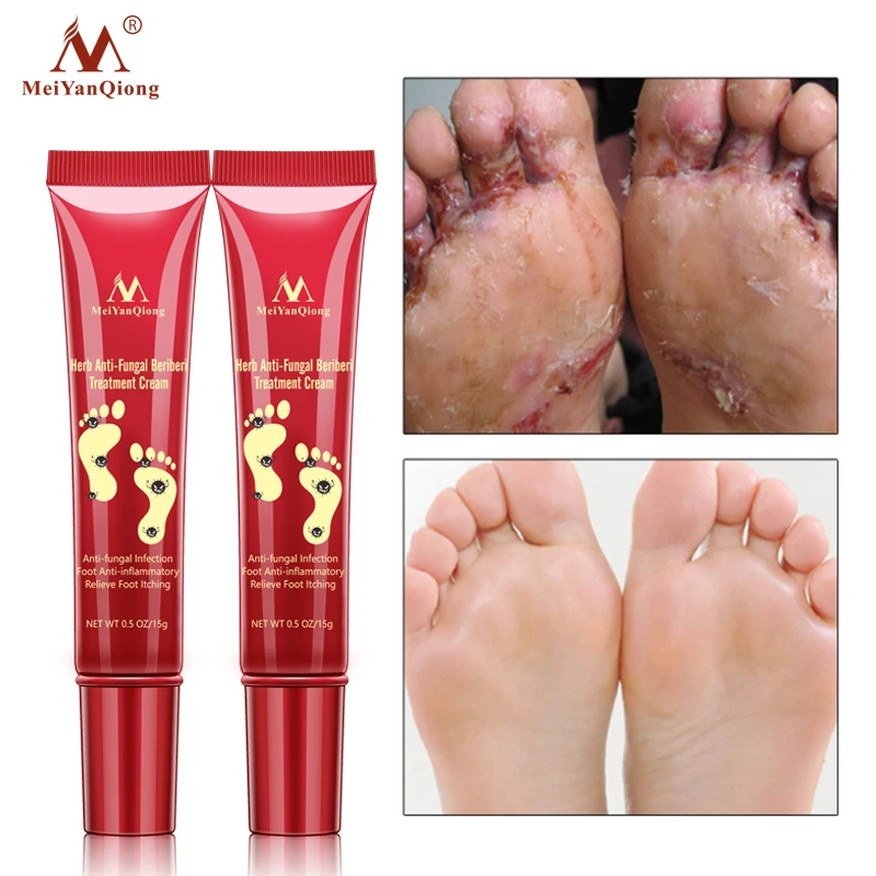 

2PCS Herbal Foot Treatment Anti Fungal Infection Onychomycosis Paronychia Toe Fungus Treatment Removal Dead Skin Hand Feet Care