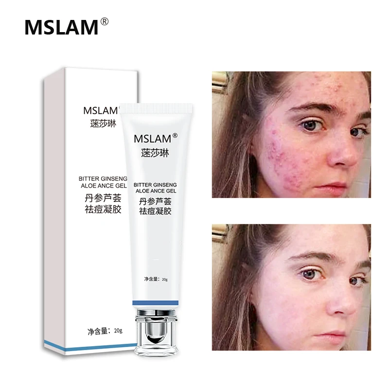 

MSLAM Skin Care Blackhead Repair GelAcne Treatment Face Creaml Oil Control Shrink Pores Scar Whitening Moisturizer