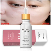 hyaluronic acid serum facial moisturizing acido hialuronico bioaqua essence hyaluronik asit skin face serum beauty moisturizer