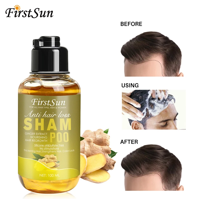 

1PCs 100ml Natural Ginger Extract Hair Loss Shampoo Hair Growth Essential Oil Shampoo Effectively Anti Hair Loss Treatment TSLM1