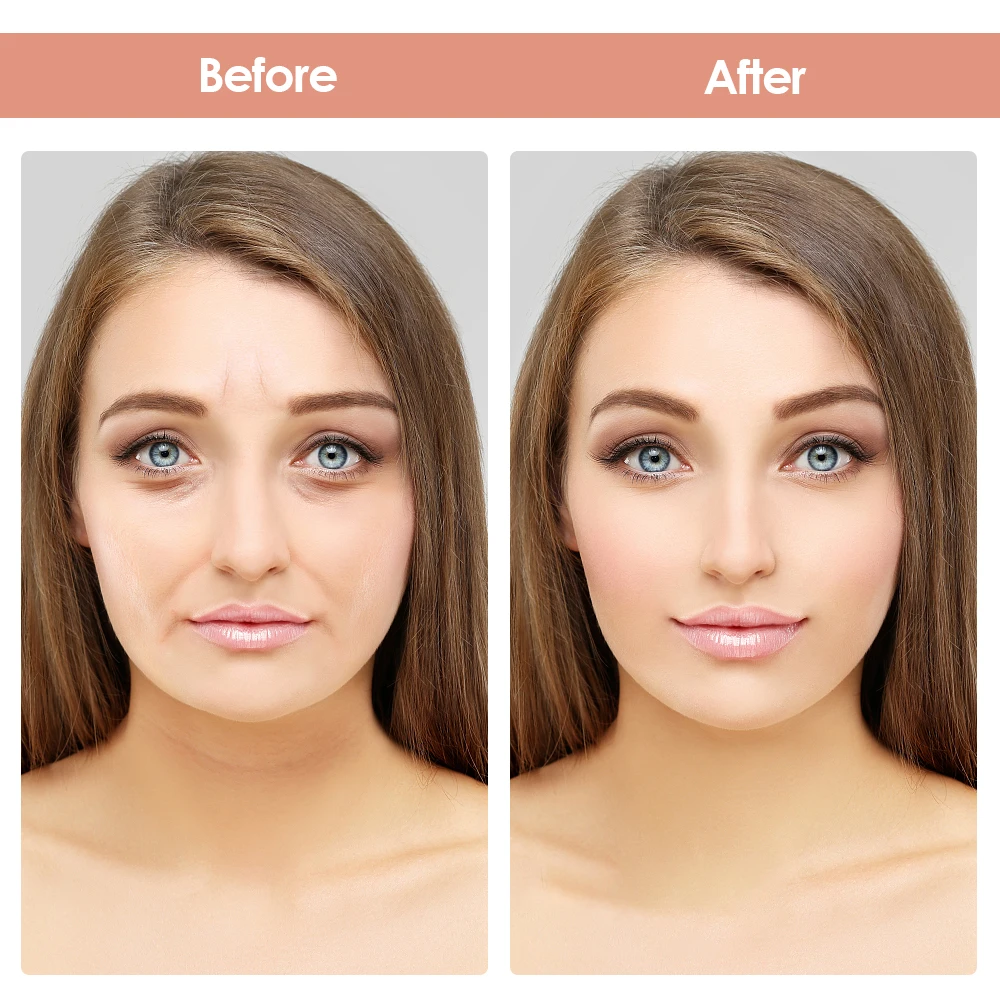 

Reusable Silicone Wrinkle Remover Sticker Face Lifting Mask Forehead Neck Eye Chin Cheek Lines Anti Aging Patches Skin Care Tool