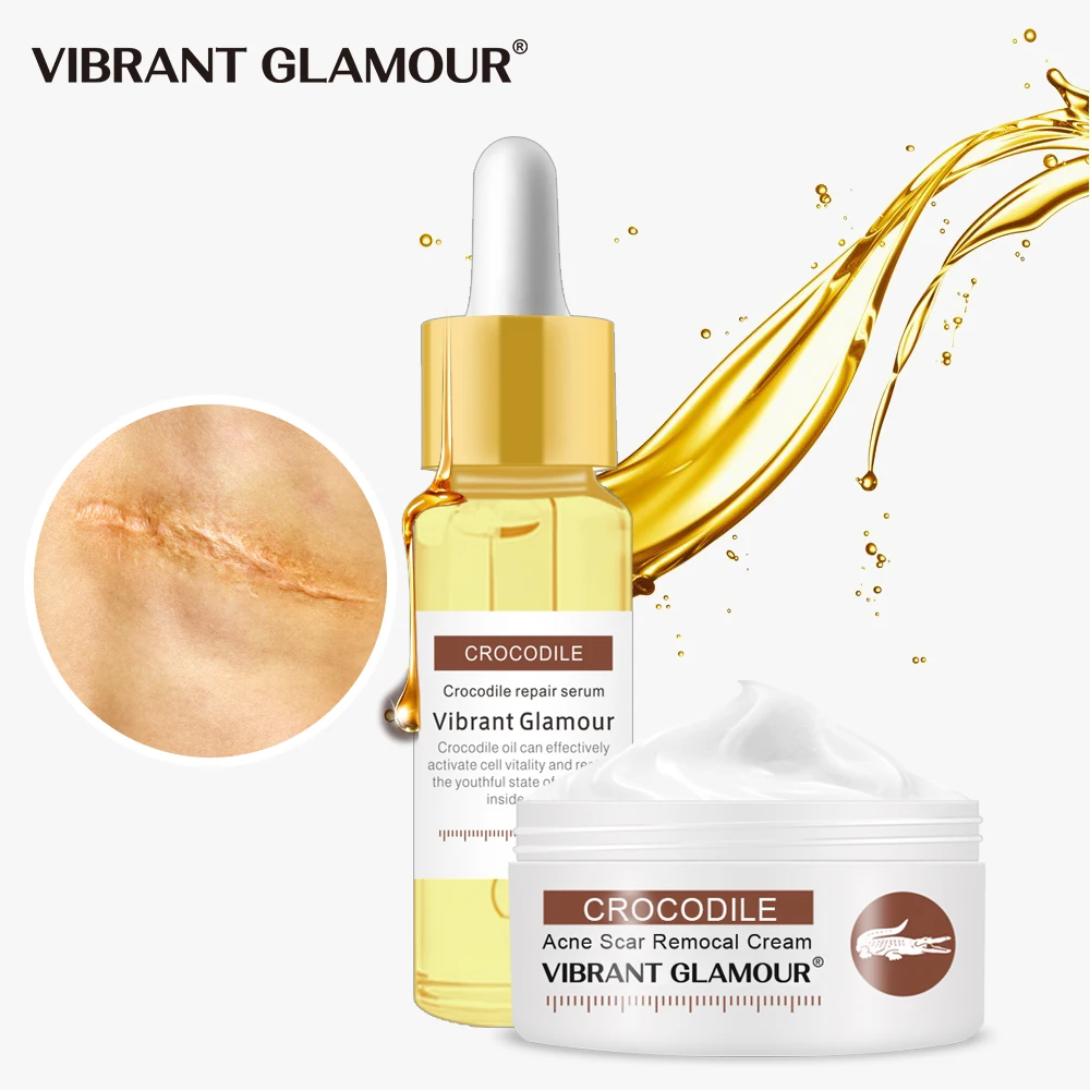 Крем для ухода за кожей крокодила от акне|Сыворотка| |