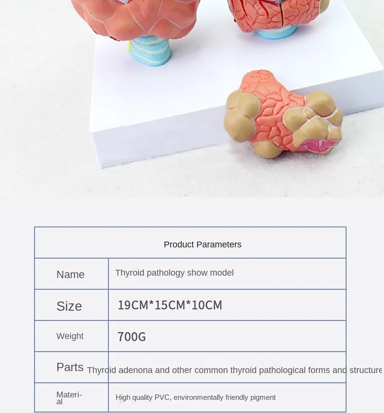 

Human anatomy, medical model, thyroid pathology model, endocrinology model for medical teaching