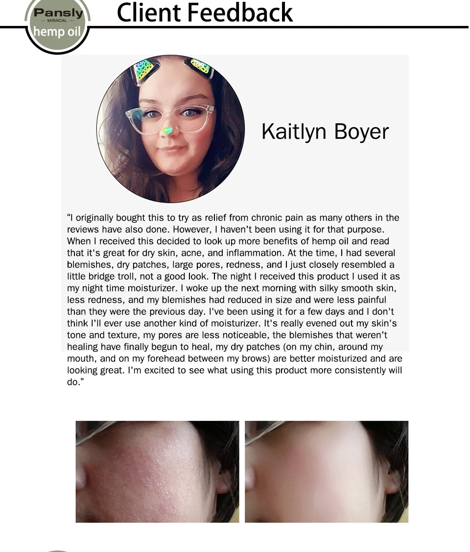 Травяные эфирные масла органические семена конопли капли снимают стресс КБР