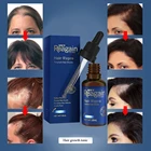 Эссенция для роста волос, эфирное масло, сыворотка для роста волос, питательное средство для смягчения, лечение выпадения волос, жидкость для восстановления женских волос