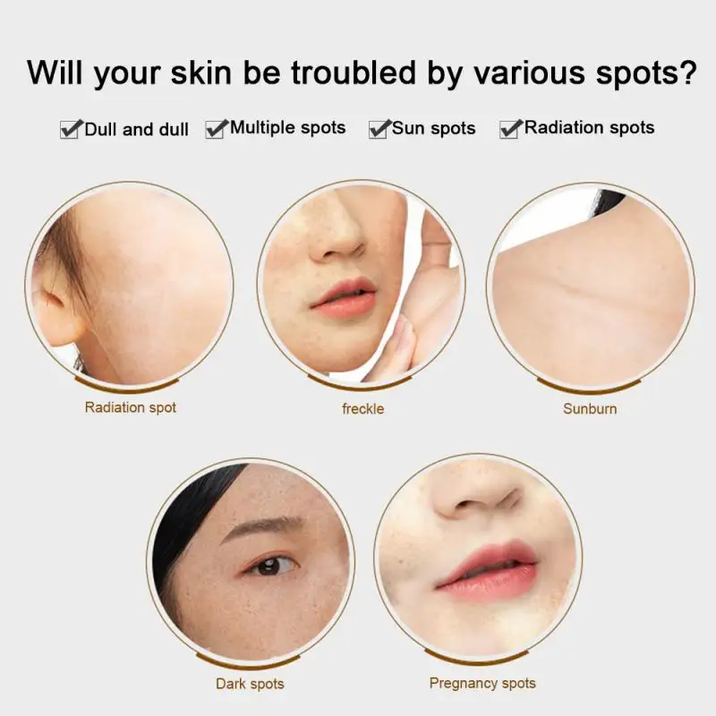 15 мл мгновенный пятна для удаления гель ВК отбеливания веснушек Сыворотки