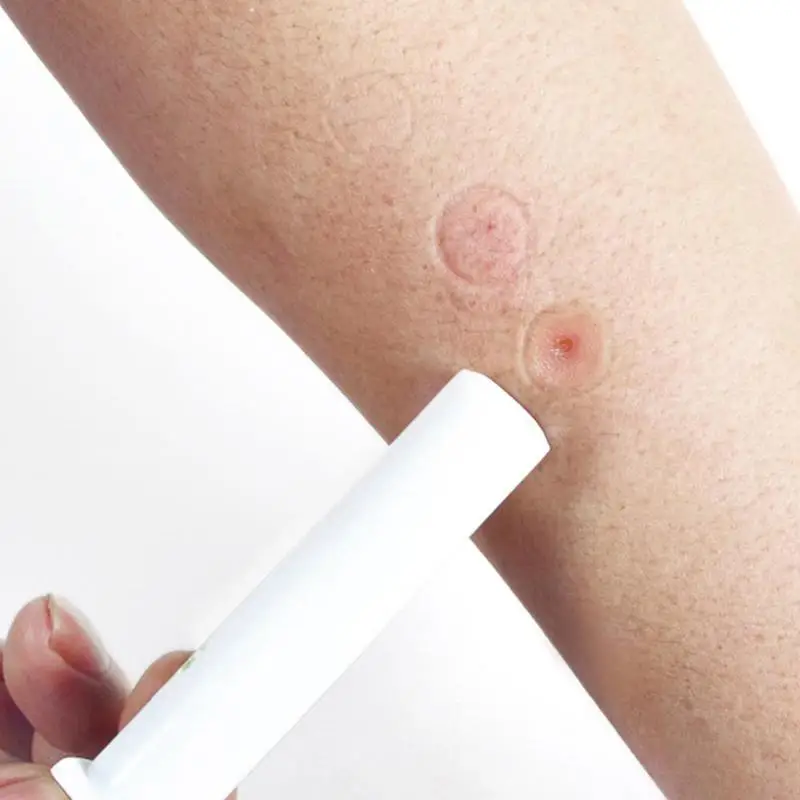 Вакуумный насос для удаления комаров аксессуары оказания первой помощи снижение