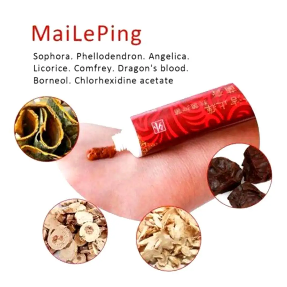 Varicose Veins Treatment Cream Effective Vasculitis Phlebitis Spider Varicosity Angiitis Ointment Herbal |