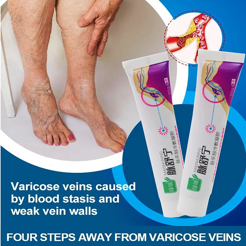 

5pcs Relieve Leg Pain Vasculitis Care Varicose Vein Ointment Varicose Veins Cold Compress Gel Phlebitis Vasculitis Swelling