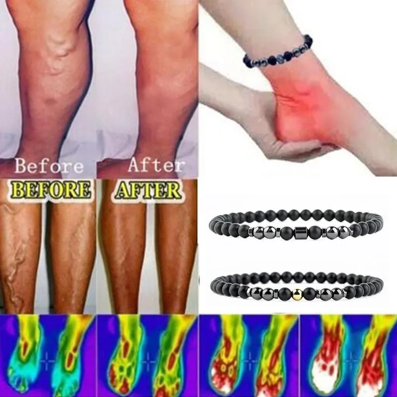 

Magnetic Anklet Anti Varicose Veins Therapy Anklets Black Gallstone Healing Biotherapy Ring Acupoint Burning Fat Body Slimming