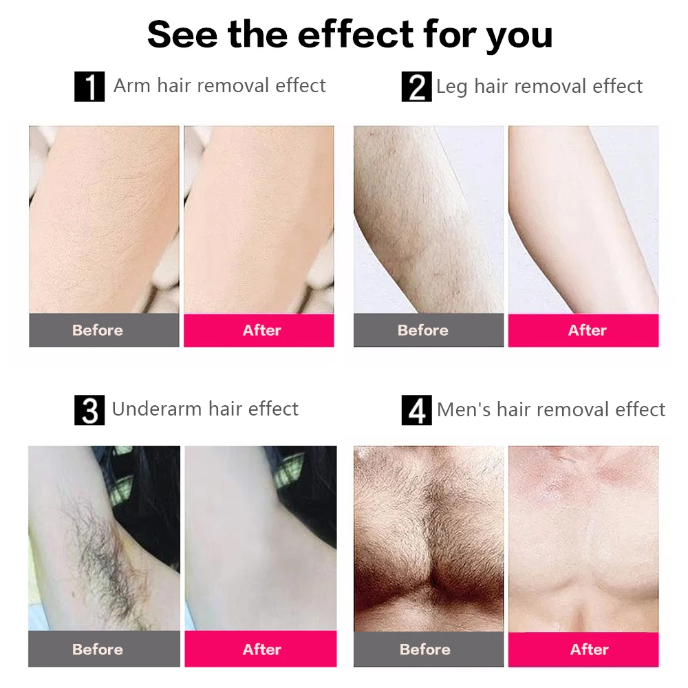 Лазерный эпилятор на 600000 вспышек аппарат для перманентного удаления волос IPL