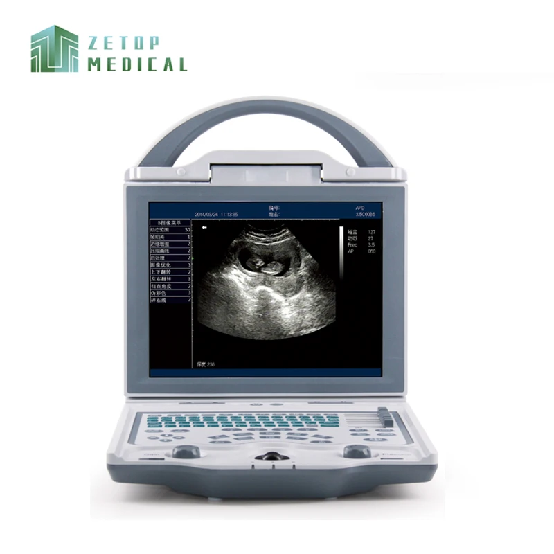 

ZT-BW-U1 Best Price Portable All Digital B/W Ultrasound System