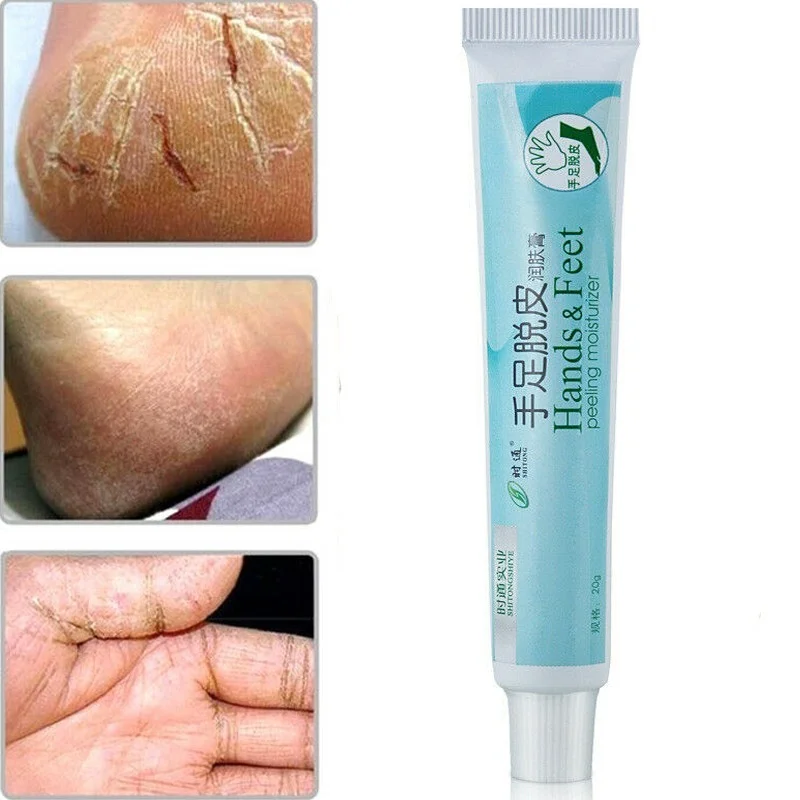 

Oil Anti-Drying Crack Feet Repair Cream Heel Hand Foot Moisturizing Feet Skin Care Dry Cracked Removal Dead Skin Hand Feet Care