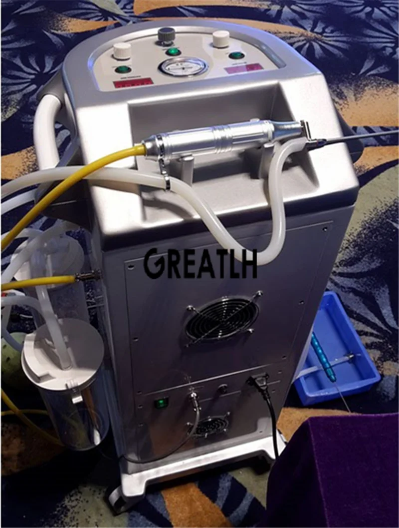 Рисунок 3 - Инфильтрация жира для удаления