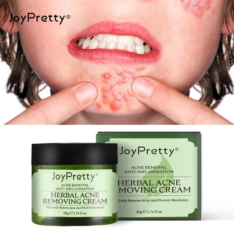 

JoyPretty Skin Care Essences Acne TreatmentFade Acne Spots Oil Control Shrink Pores Whitening Moisturizing Acne Cream Skin Care