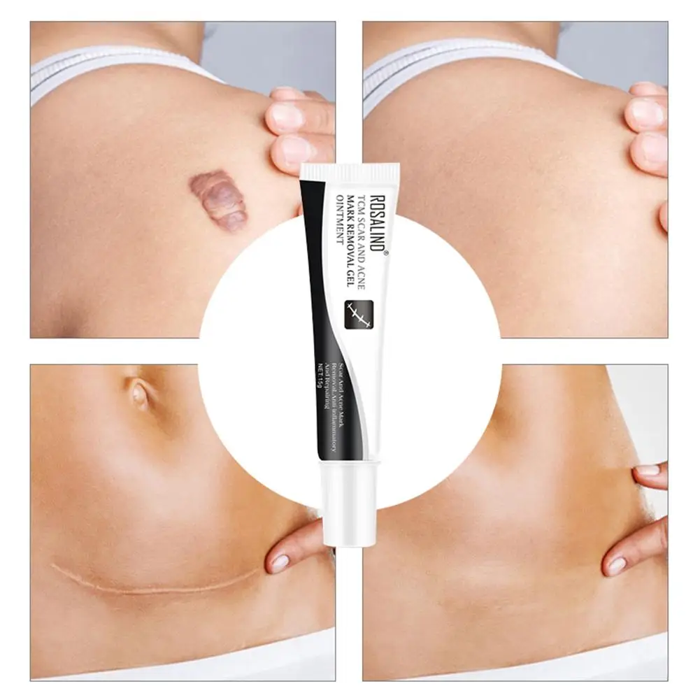 15 г Восстанавливающий шрамовый Крем гель для удаления акне шрамы растяжки шрам