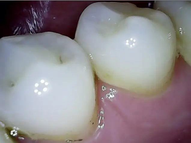 Новая Проводная интраоральная камера для мобильного телефона и смартфона