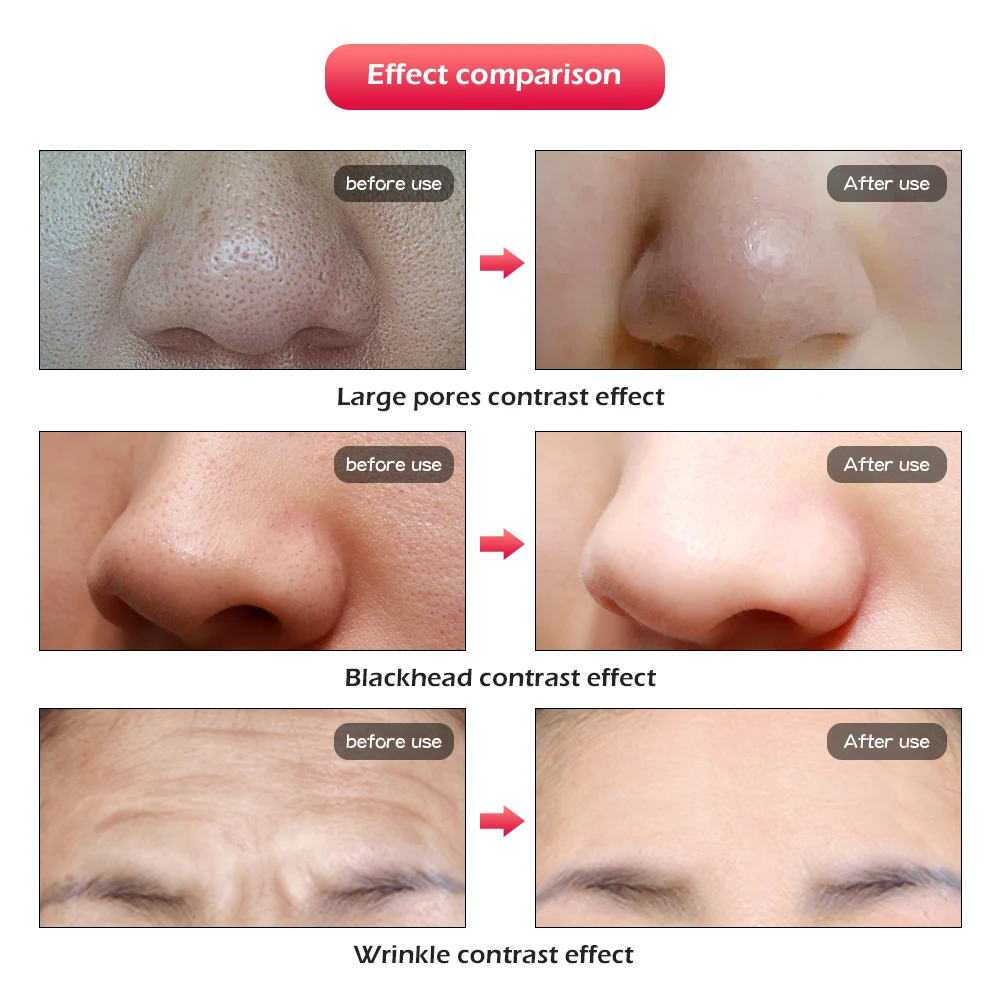 7 цветов Светодиодная терапевтическая маска светильник для лица терапия Фотон