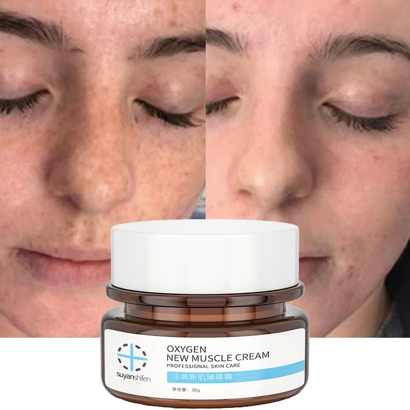 

30g Face Cream Remove Freckles Dark Spots Fade Fine Lines Gel Whitening Moisturizing Brightening Facial Skin Care Cream Beauty
