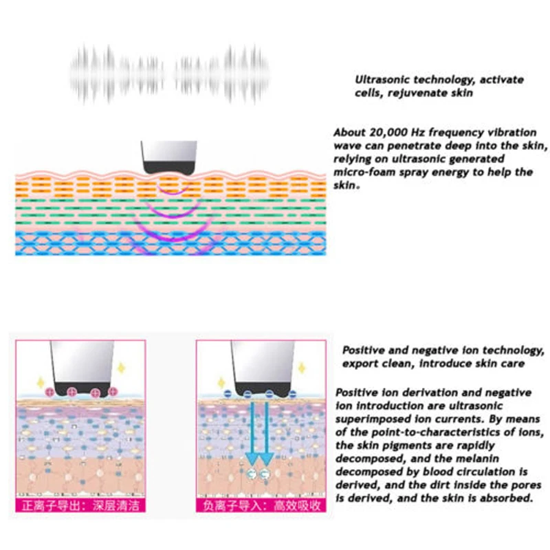 Ультразвуковой скраб для кожи лица удаления угрей Отшелушивающий уменьшает