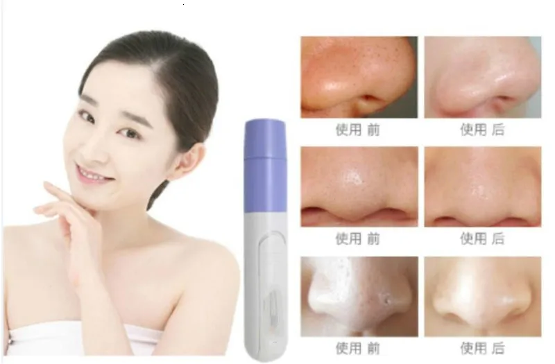 Электрический прибор для удаления акне Noir Blackhead вакуумный экстрактор инструмент для удаления черных точек очиститель пор уход за кожей Массажер для подтяжки лица набор инструментов