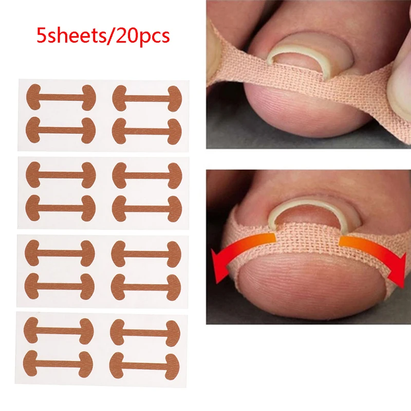 

20pcs Ingrown Toe Foot Nail Correction Sticker Pedicure Toenail Corrector