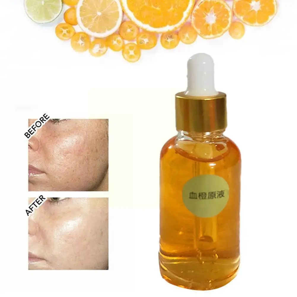 

Strong Lightening Oil Dark Skin Lightening Oil Fast Lightening Skin Action Oil Strong R3Y8