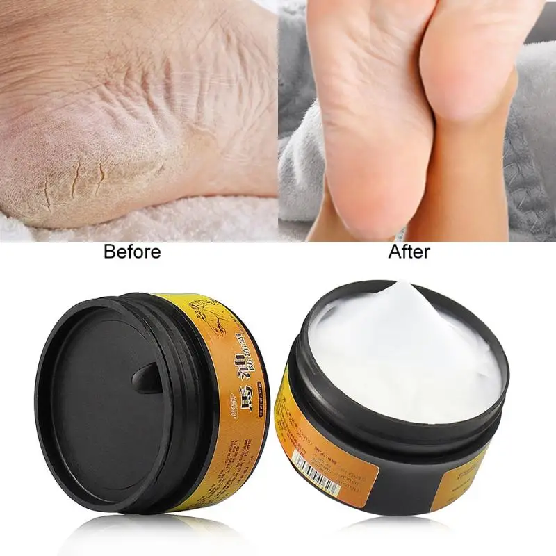 

Horse Oil Repair Skin Care Product Anti-Drying Crack Cream Strong effective heel cream Feet Dead Skin Remover Cream Foot Scrub