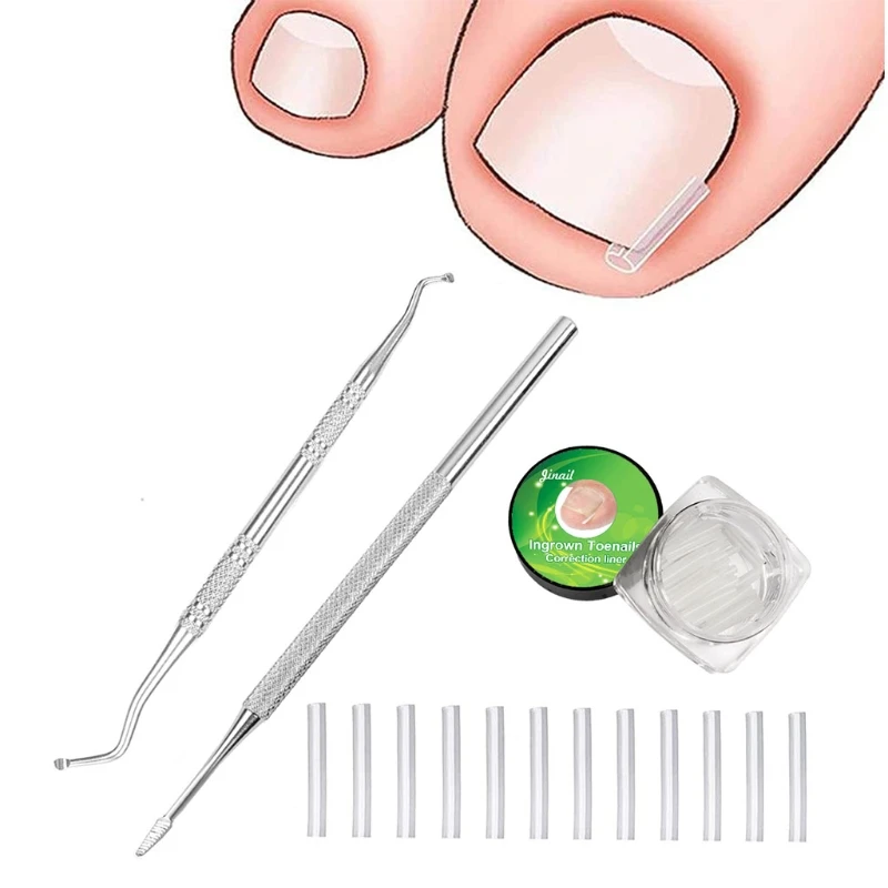 

Средство для очистки вросших ногтей из нержавеющей стали