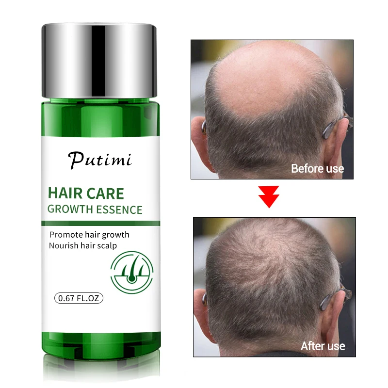 Putimi мощная Сыворотка для роста волос продукты против выпадения сыворотка более