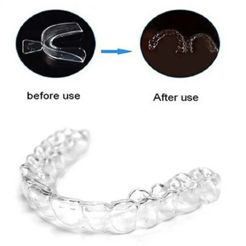 5 шт. одноразовые прозрачные отбеливающие зубные скобы|Отбеливание зубов| |