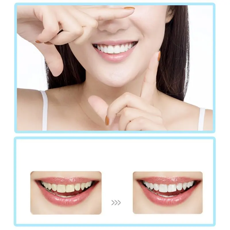 

Vibrition Sonic Dental Scaler Usb Recharge Eletric Toothbrush Calculus Remover