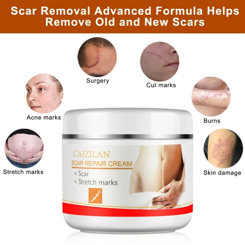 30g Acne Scar Stretch Marks Repair Cream Removal Spots Blackhead Whitening Skin For Scald Marks Skin Smoothing Scar Repair Cream