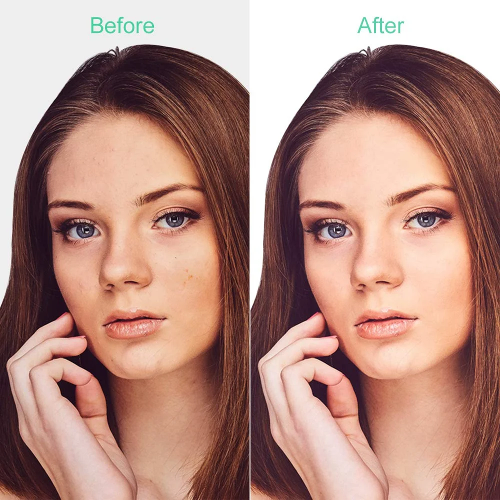 Лазерная плазменная машинка для удаления татуировок Tlinna с ЖК