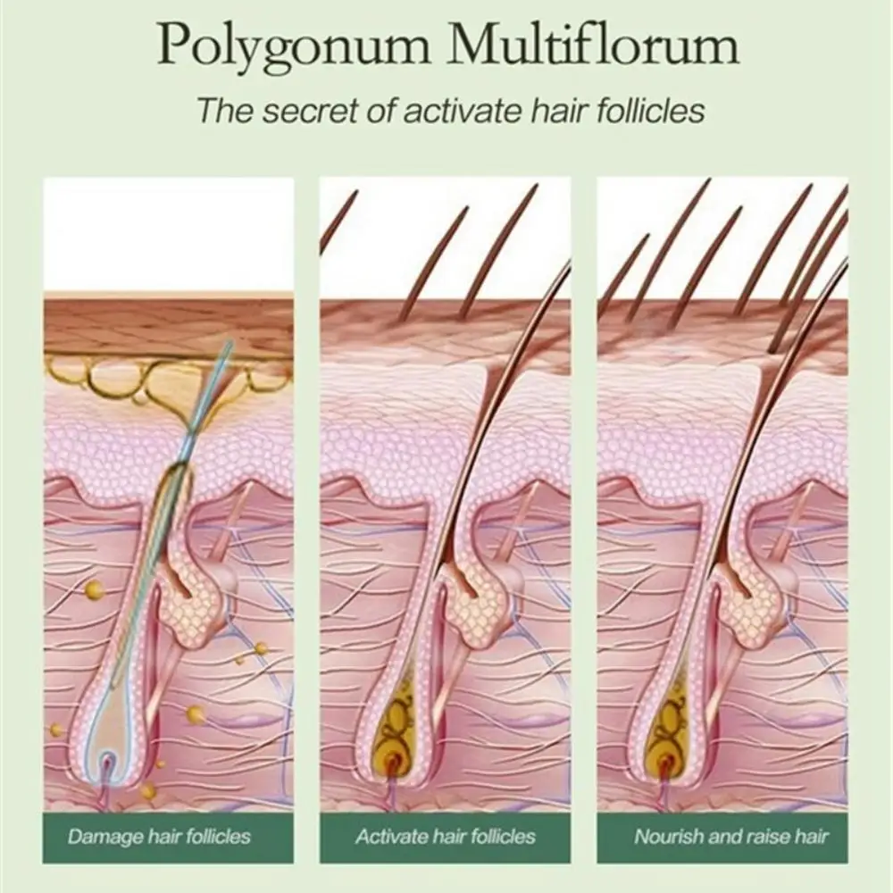 Имбирный спрей для роста волос эфирное масло выпадения жидкий мужчин и женщин
