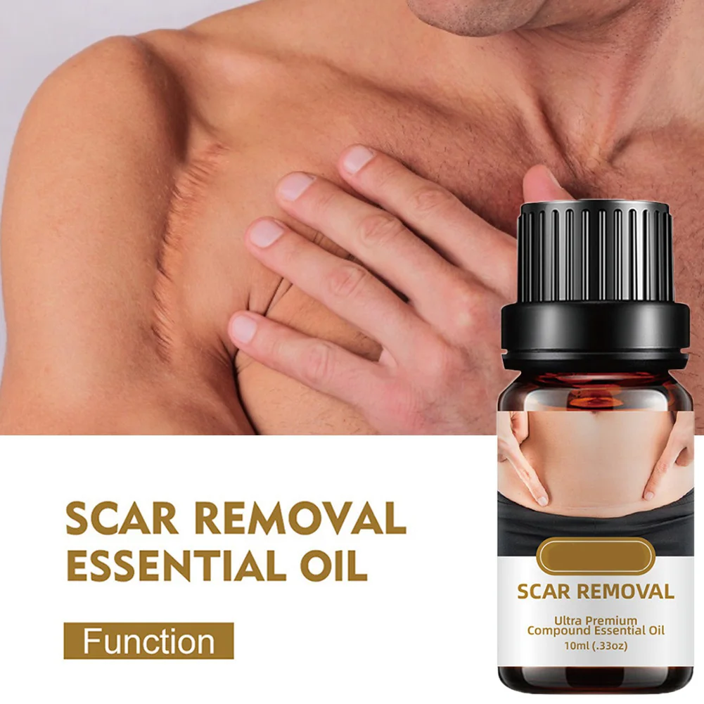 

Natural Stretch Marks Remover Obesity Postpartum Marks Removal Essential Oils Pure Anti Repair Cream Skin Care