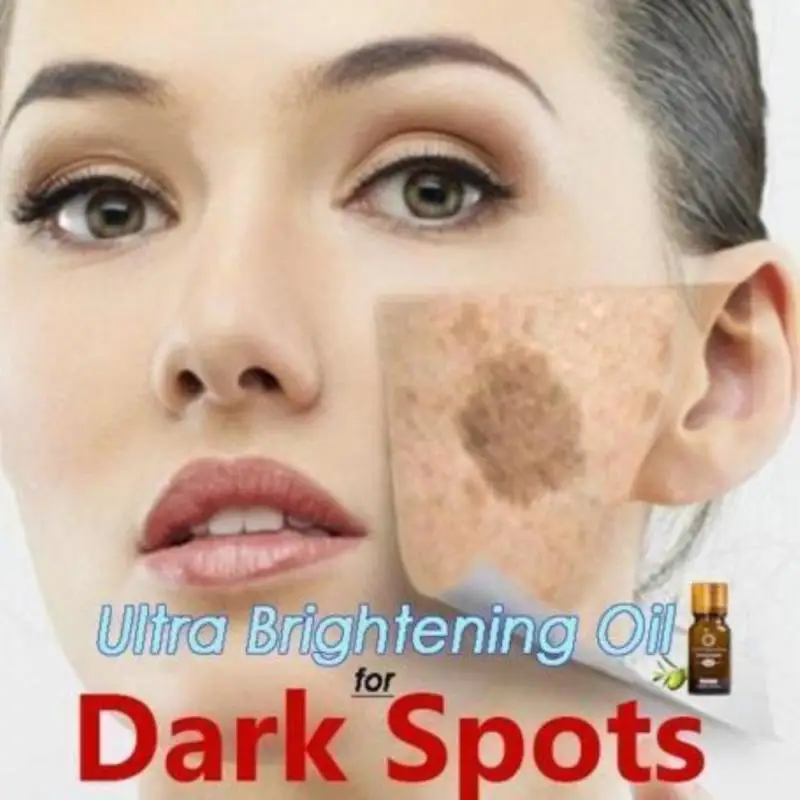 

10ml Natural Essential Oil Ultra Brightening Spotless Skin Whitening Essence Remove Dark Spots Ance Burn Scar Smooth Skin Care