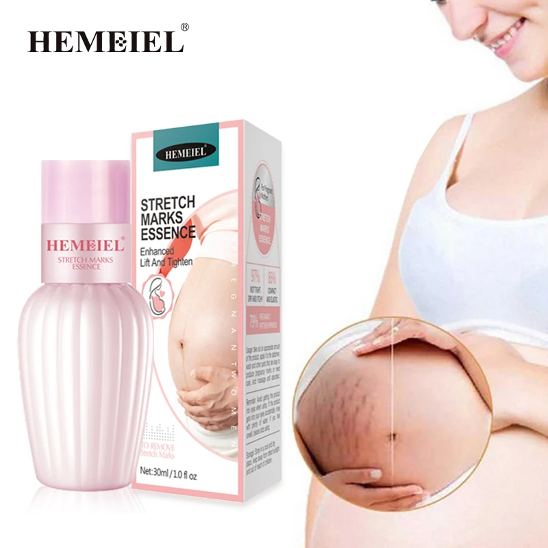 

Pregnancy Stretch Marks Repair Cream for Pregnant Woman Scar Remove Cream Whitening Moisturize Cream for Stretch Mark Treatment