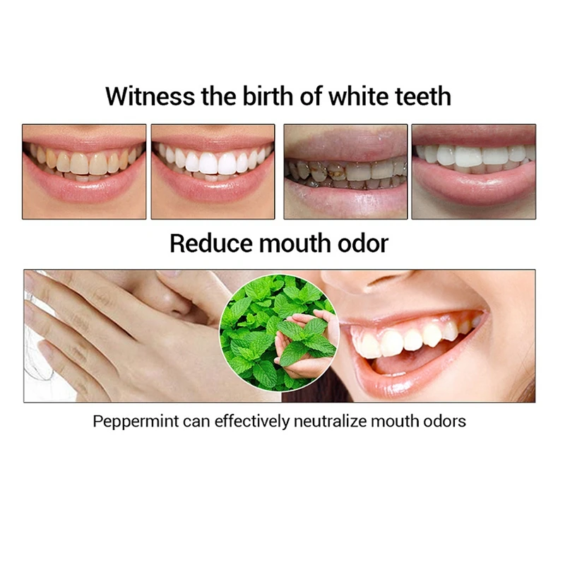 

New Oral Teeth Whitening Clean Home Use Teeth Stains Scaling Tool Teeth Stain Remover Tartar Scaler Cleansing Machine