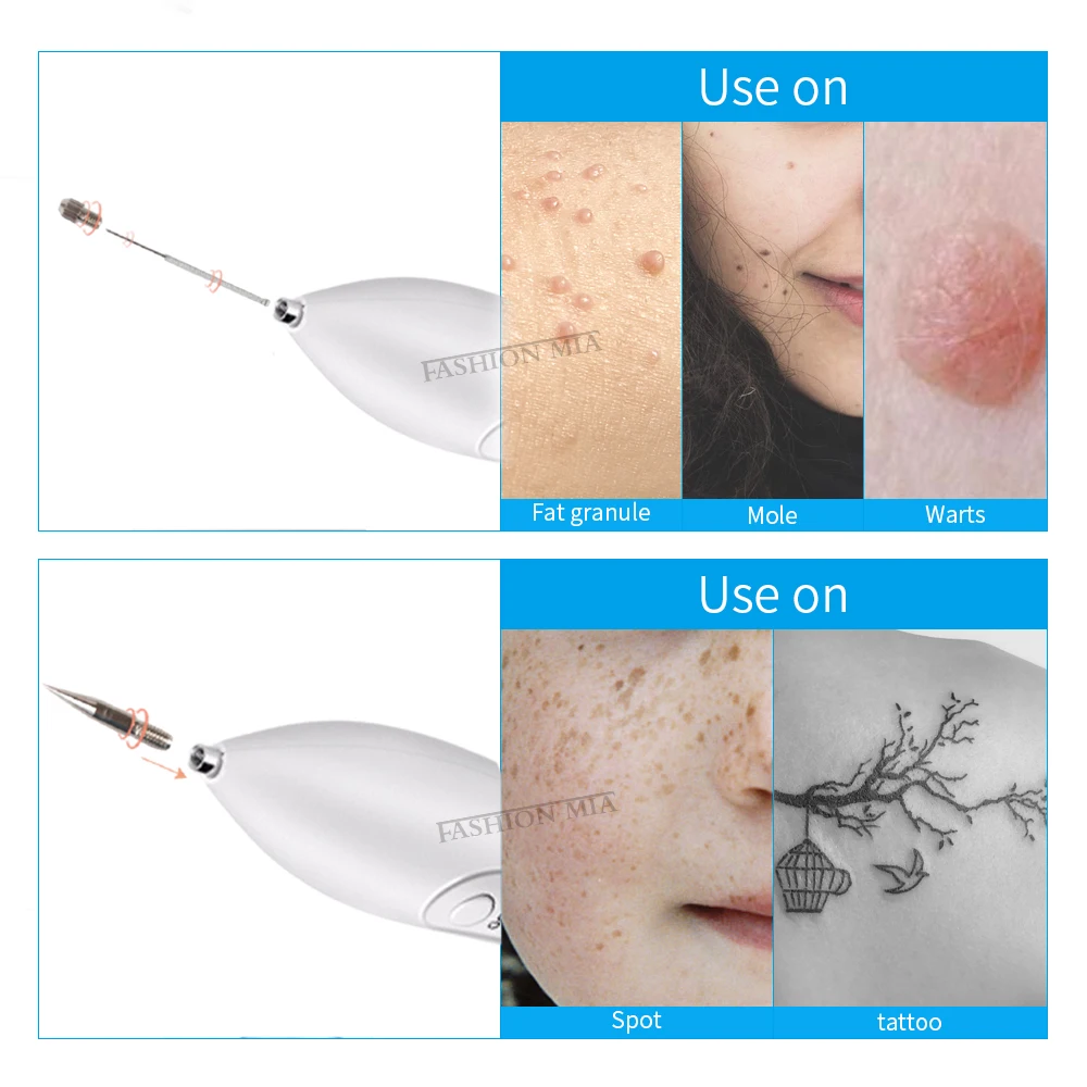 Микро-иглы для удаления родинок плазменная ручка тонкие иглы лазерной этикетки
